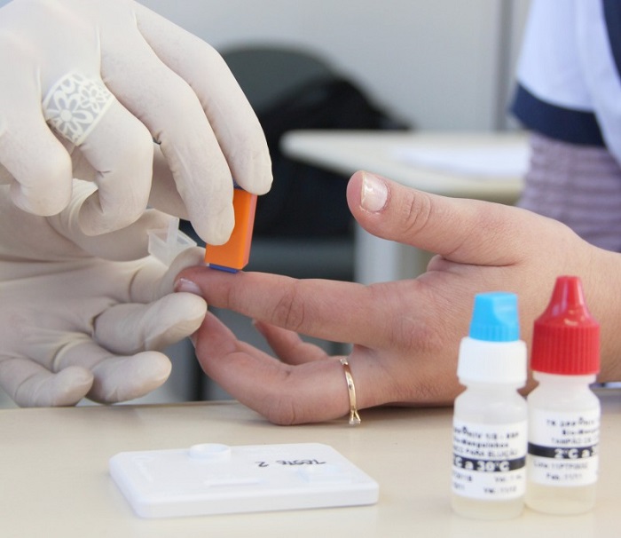 Dia Mundial de Combate à Aids: testes rápidos são oferecidos em todas Unidades de Saúde de Araranguá
