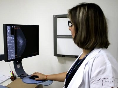 Ministério da Saúde recomenda mamografia no SUS a partir dos 40 anos