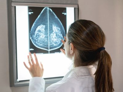 Plano de saúde terá que cobrir mamografia digital para todas as idades