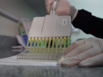 Pesquisa na Unesc foca no aprimoramento de testes de Sífilis e na identificação precoce dos casos em bebês