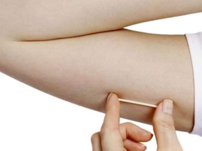 Balneário Gaivota amplia rede de cuidados e passa a oferecer o método contraceptivo Implanon no SUS